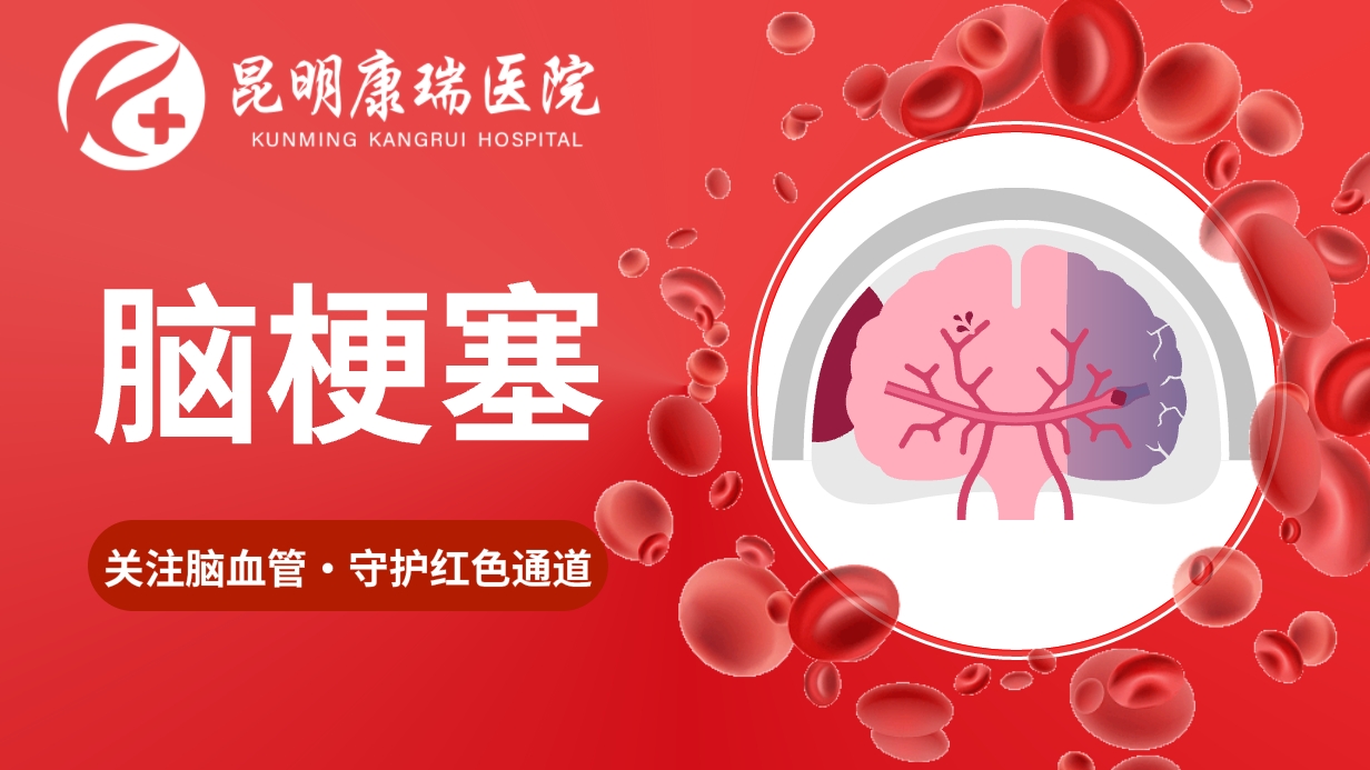 脑梗塞